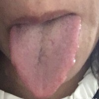 Oral-cancer project thumbnail