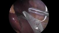 Tools delection project thumbnail