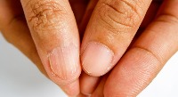 Nails project thumbnail