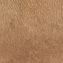 Melanoma Detection Classification Dataset And Pre Trained Model By