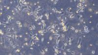 cancer_cell project thumbnail