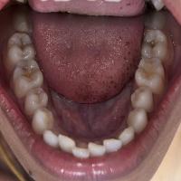 mandibular project thumbnail