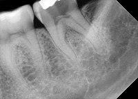 Radiograph project thumbnail