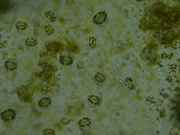 CellSegmentation project thumbnail