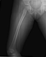 bone project project thumbnail