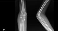 bone project thumbnail