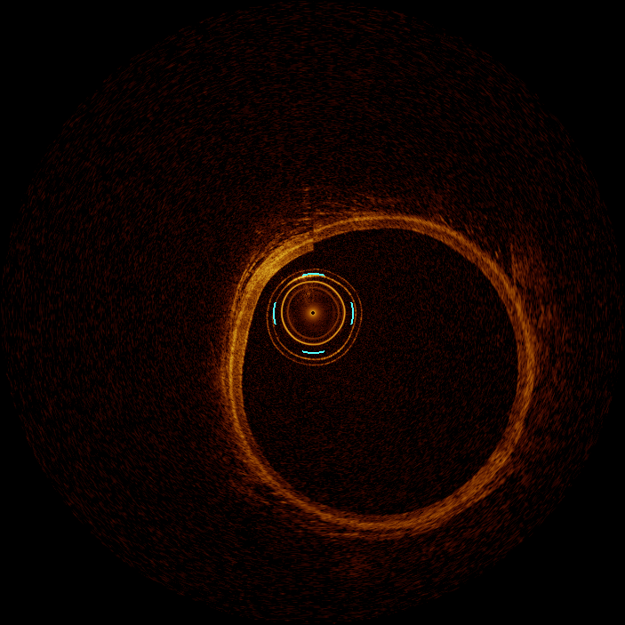 My First Project Instance Segmentation Model by project-uqxsl