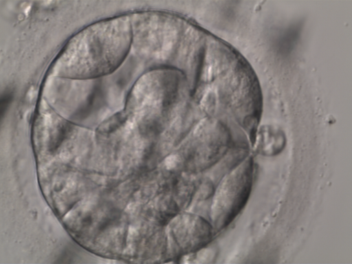 My First Project Instance Segmentation Model by embryo