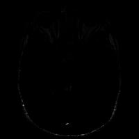 LowTumor project thumbnail