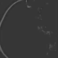 tumor1bboxGamma5FineTunedRetinex project thumbnail