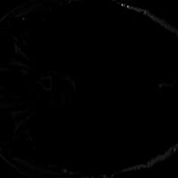 tumor1bboxGamma5 project thumbnail