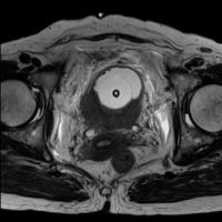 Center project thumbnail