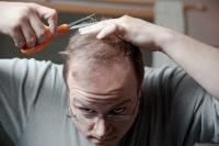 Scalp project thumbnail