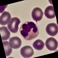 Neutrophils and Lymphocytes project thumbnail
