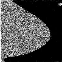 breast_cancer_detection project thumbnail