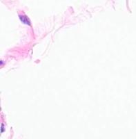 Neutrophil project thumbnail