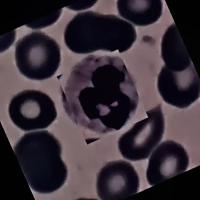 Neutrophil and Lymphocyte project thumbnail