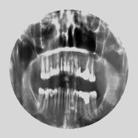 dental project thumbnail