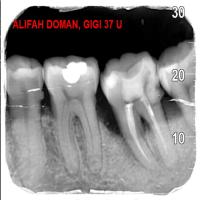 periapical xrays project thumbnail