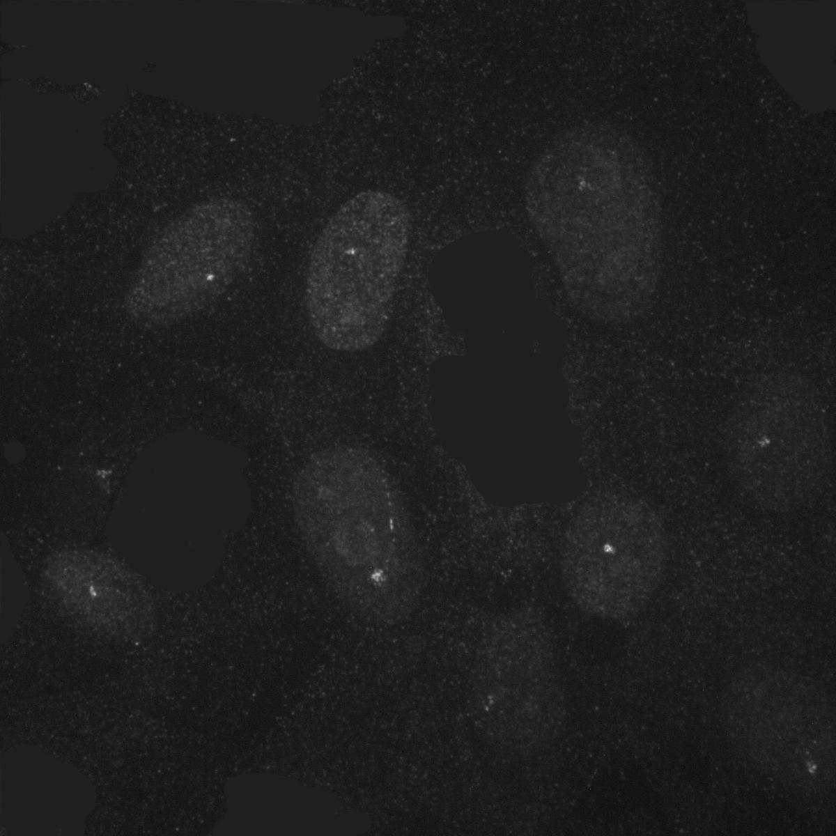 centrosome-new-catarina-object-detection-dataset-by-tecnico