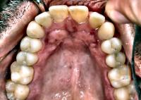 SAM2-Dientes-Seg project thumbnail