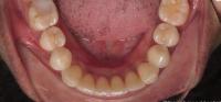 SAM2-Dientes-Seg-NonProcess project thumbnail
