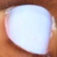 Nails Identification project thumbnail