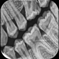 dental-segmentation project thumbnail