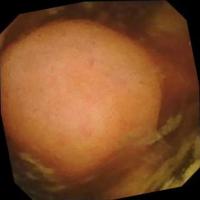 Medical project thumbnail
