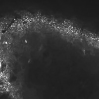 astrocyte project thumbnail