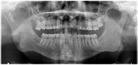 dentex dataset project thumbnail