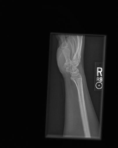 MURA Object Detection Dataset and Pre-Trained Model by admin