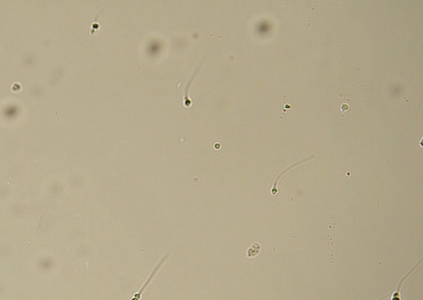 Sperm Detection Sperm Head Detection - Final Object Detection Model by Sperm Motility ...