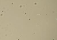 Sperm Head Detection - Final project thumbnail