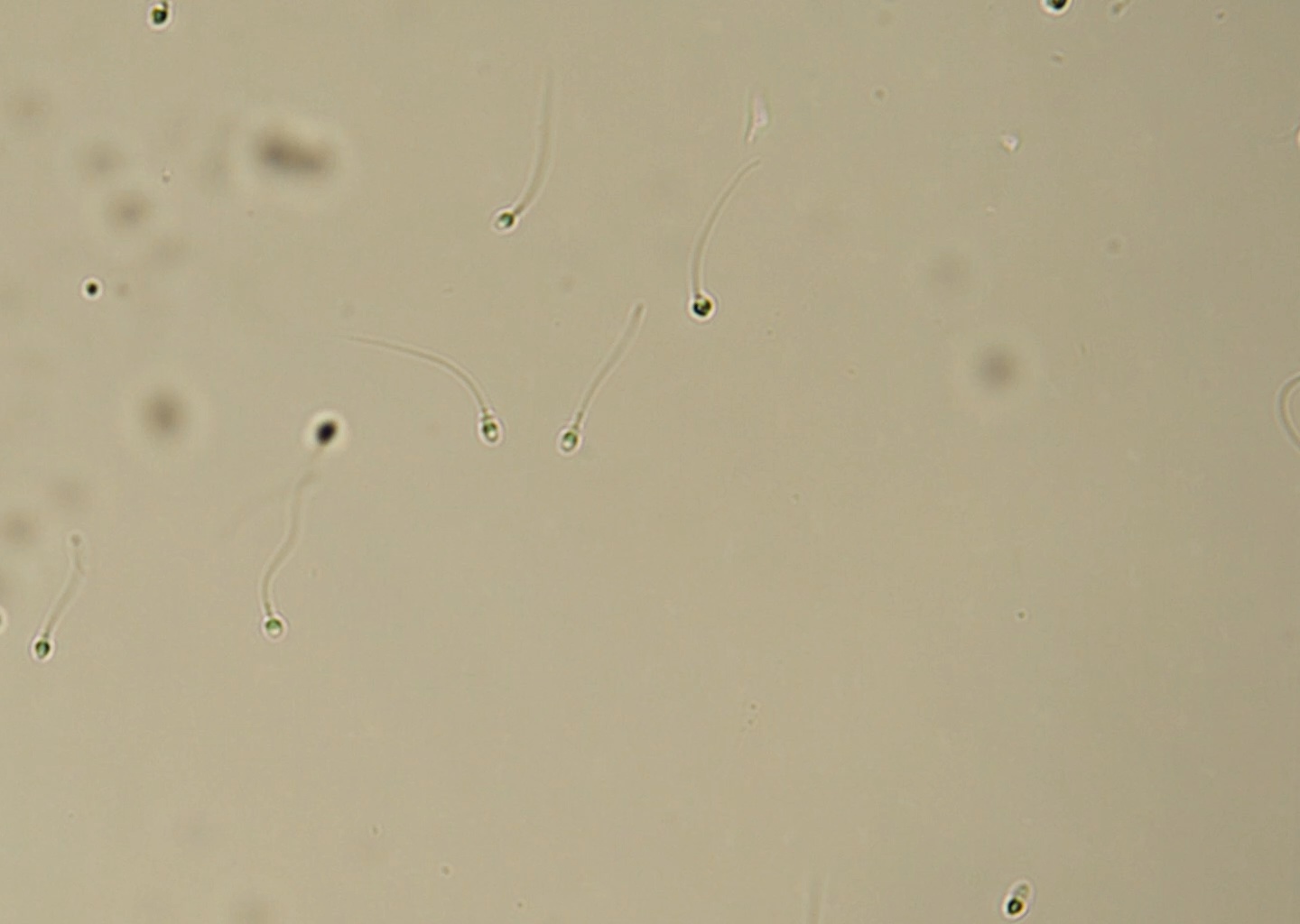 Sperm Detection Full Sperm Cell Detection Object Detection Model by Sperm Motility ...
