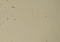 Full Sperm Cell Detection project thumbnail