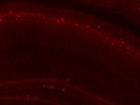 Neuron Detector project thumbnail