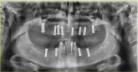 dental_box_v2 project thumbnail