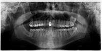 Dental_training_dataset_v2 project thumbnail