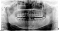 dataset_dentes project thumbnail