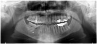 dataset_original project thumbnail