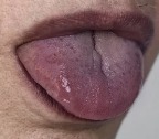 Oral Cancer project thumbnail