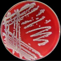 Bacillus subtilis_media plate project thumbnail