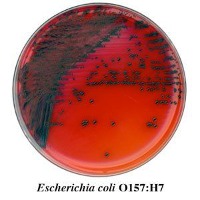escherichia-coli_media-plates project thumbnail