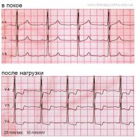 ecg-v1 project thumbnail