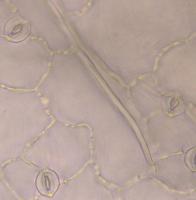 Stomata project thumbnail