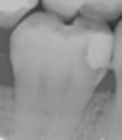 0402Bilateral project thumbnail
