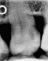 0402CLAHE project thumbnail