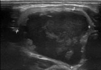 Find nodules 3 project thumbnail