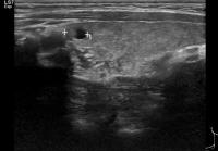 Find nodules project thumbnail
